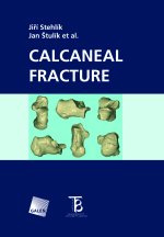 CERVICAL SPINE TRAUMA